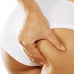 Remedies for Cellulite